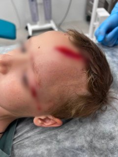 Собака напала на внука Дарьи Донцовой: подробности инцидента