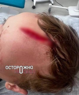 В Одинцово собака атаковала 7-летнего мальчика: подробности инцидента