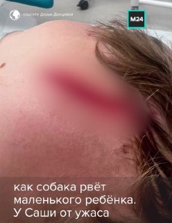 Внук Дарьи Донцовой пострадал от нападения собаки в Подмосковье